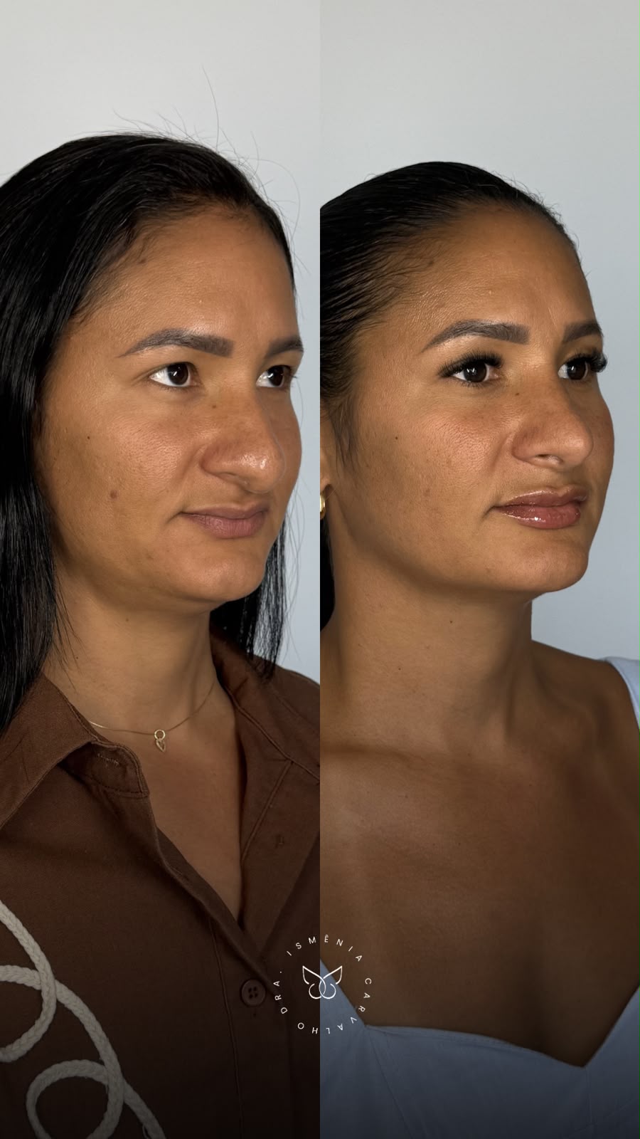 Antes e depois de Rino Sculpt